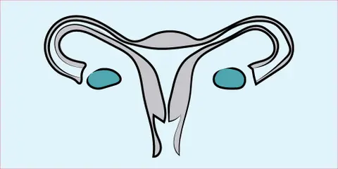 Contraception