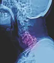 Episode 62 - Cervical Spine Injuries- An Interview with Dr. Jara-Alamonte