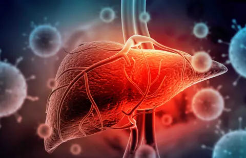 Liver Series – Liver Cancer (Malignant Liver Lesions)