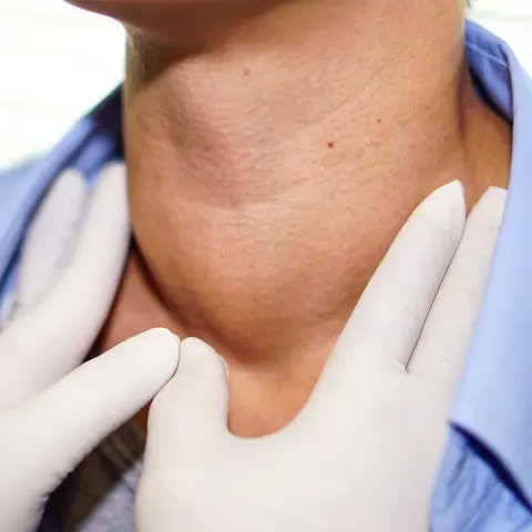 Thyroid Emergencies