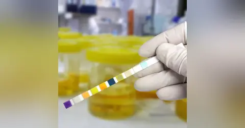 Pediatric UTI and Pneumonia