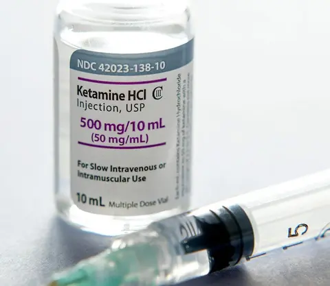 Ketamine Pro Tips