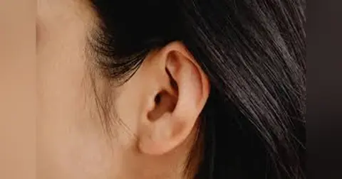 Tympanic Membrane Perforations