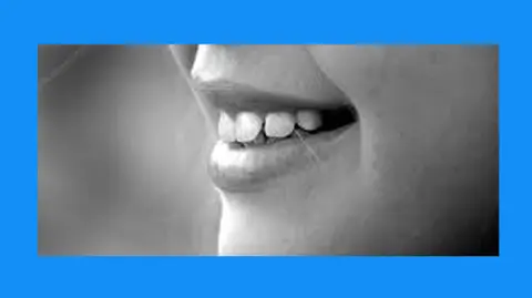 My Journey to Dental Implants: Part 2