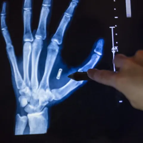 S9: The Invisible Crime: Illegal Microchip Implants and Microwave Technology - Replay