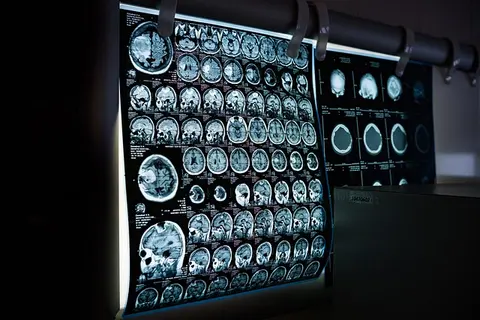 How AI Is Transforming Healthcare and Drug Discovery
