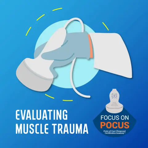 Evaluating Muscle Trauma: POCUS as First Line Imaging