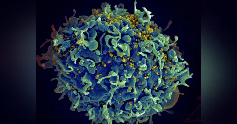 Episode 59 – HIV – An Interview With Dr. Daniel Egan