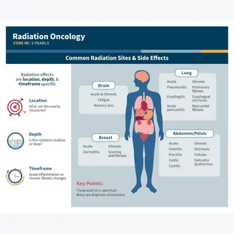 #126 Radiation Oncology Part 1: 5 Pearls Segment