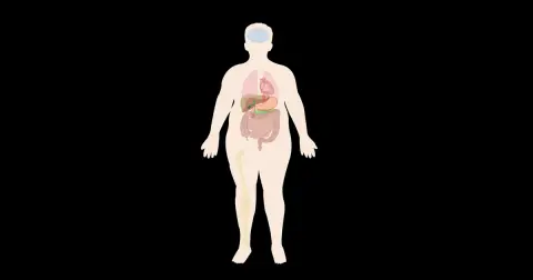 Introduction to Obesity
