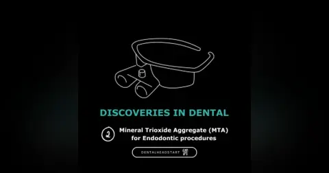 Discoveries in Dental Focus #2 – Mineral Trioxide Aggregate (MTA) for Endodontic procedures