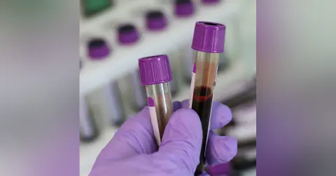Conversation - High Sensitivity Troponin