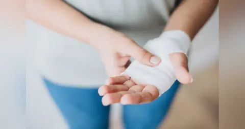 Skier’s Thumb