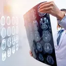 School Re-entry After a Brain Injury