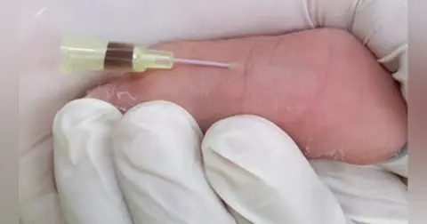 Pediatric Electrolyte Emergencies