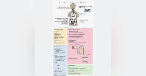 #137 Hypokalemia & Potassium Repletion: 5 Pearls Segment