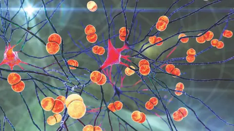 Episode 68 -- Meningitis and Encephalitis – An Interview with Dr. Andrew Hogan