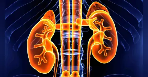 Benign Renal Masses