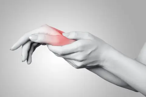 De Quervain’s Tenosynovitis