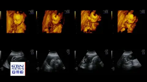 Horror Show': Watchdog Reveals FDA Paid for 'Fresh Human Fetal Parts' for 'Humanized Mice' Experiments