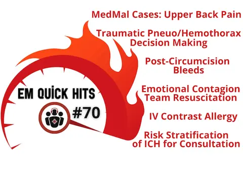 EM Quick Hits 70 MedMal Cases Upper Back Pain, Traumatic Pneumothorax/Hemothorax Decision Making, Risk Stratification of ICH for Consultation, Post-Circumcision Bleeds, IV Contrast Allergy, Emotional Contagion