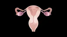 Endometrial Cancer Introduction