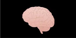 Intracranial Aneurysms