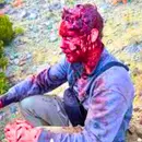 I was mauled by a bear and I fought it off. Ask Me Anything!