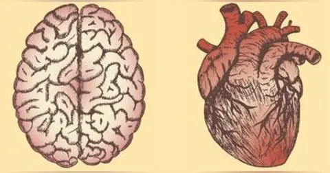 Infective Endocarditis-Associated Stroke