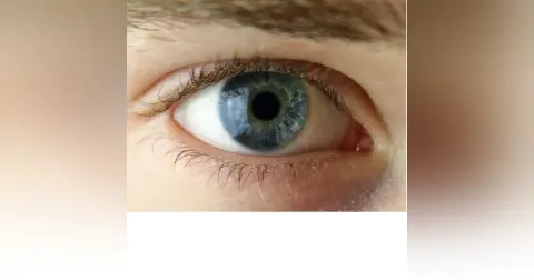 Eye Fundamentals