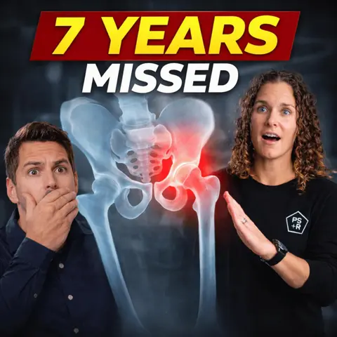 Why Hip Dysplasia Goes Undiagnosed for 7 Years