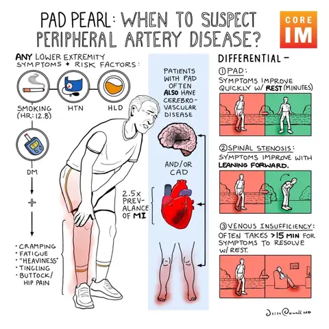 #165 Peripheral Arterial Disease: 5 Pearls Segment