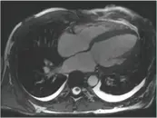 Episode 31: Cardiac MRI Update