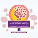 #35 Acute Coronary Syndrome and TIMI Risk Score: Mind the Gap Segment