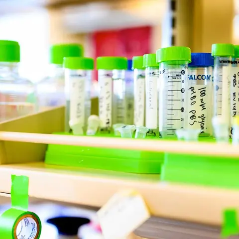 Two New Breakthroughs Advance Neurological Disorders and Cancer Research