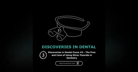 Discoveries in Dental Focus #3 – The Pros and Cons of Using Silver Fluoride in Dentistry