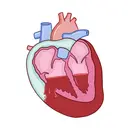 Cardiac Tamponade