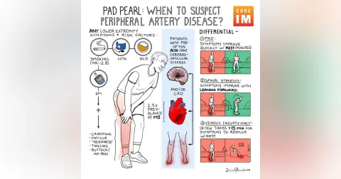 #165 Peripheral Arterial Disease: 5 Pearls Segment