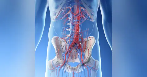 Acute Mesenteric Ischemia