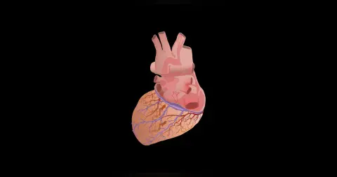 Tricuspid Valve Atresia
