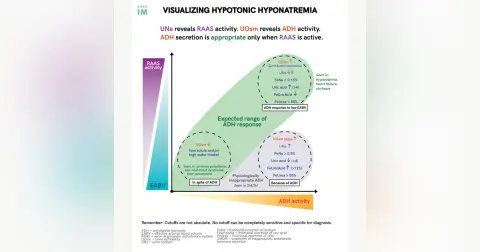 #82 Hyponatremia Diagnostics: 5 Pearls Segment