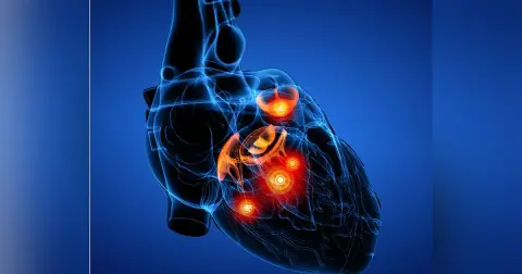 Valvular Emergencies