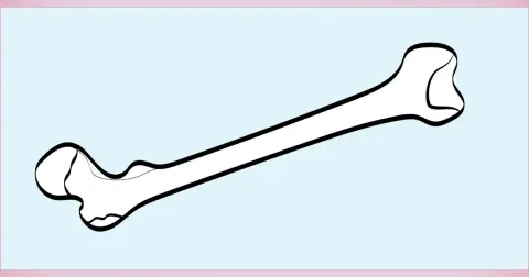 Septic Arthritis