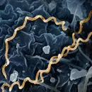 Syphilis: The Great Masquerader