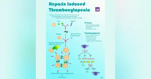 #53 Heparin-Induced Thrombocytopenia: 5 Pearls Segment