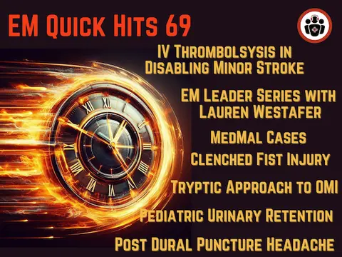 EM Quick Hits 69 Pediatric Urinary Retention & Acute Transverse Myelitis, Post-Dural Puncture Headache, Med Mal Cases: Clenched Fist Injury, IV Thrombolysis for Minor Stroke, EM Leadership Spotlight #4