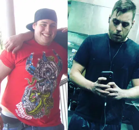 Episode 72 Multiple Sclerosis Left Tim With Muscle Spasms, Blindness, Depression & Unable To Walk