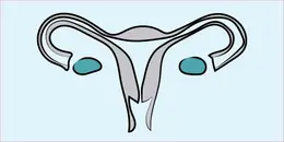 Abnormal Uterine Bleeding