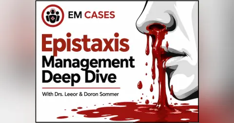 Ep 223 Epistaxis Management: A Step-Wise Approach