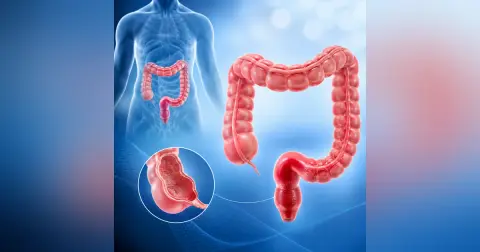 Surgical Management of Rectal Cancer – Part 2